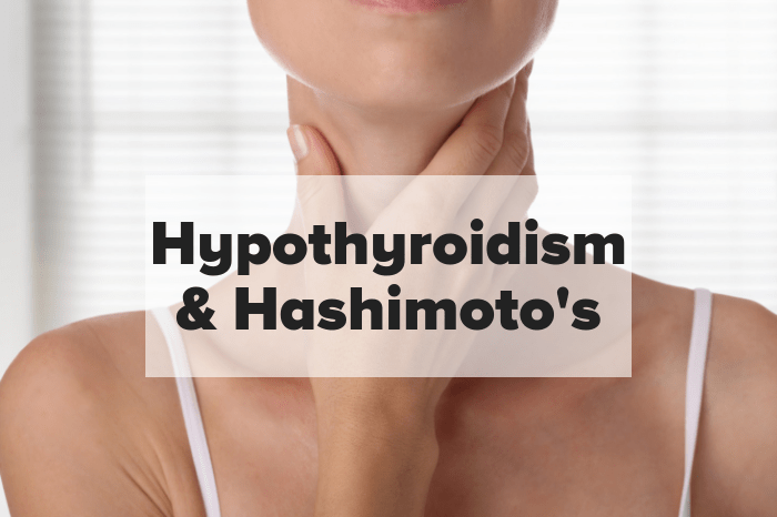Hypothyroidism & Hashimoto's
